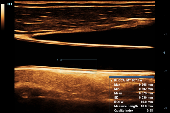 Mindray DC-60 Exp X-Insight