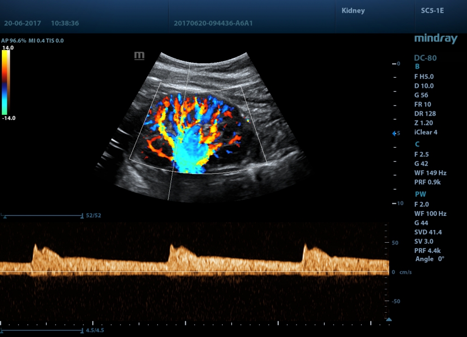 Mindray DC-80 X-Insight