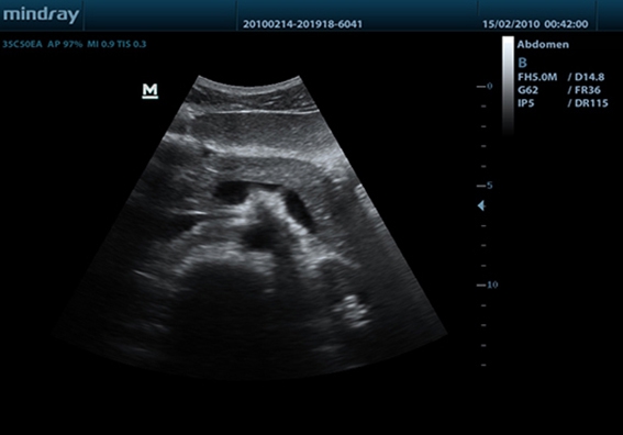 Mindray DP-50 Color