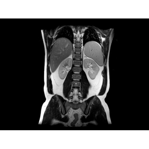 МРТ аппарат GE SIGNA Explorer 1.5T