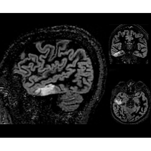 МРТ аппарат GE SIGNA PET/MR 3.0T