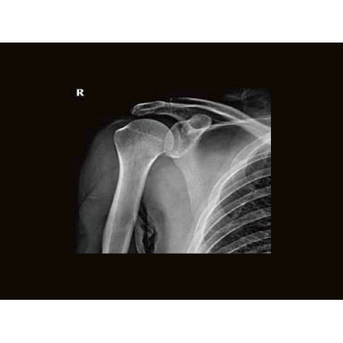 Цифровой рентген аппарат GE Brivo XR575