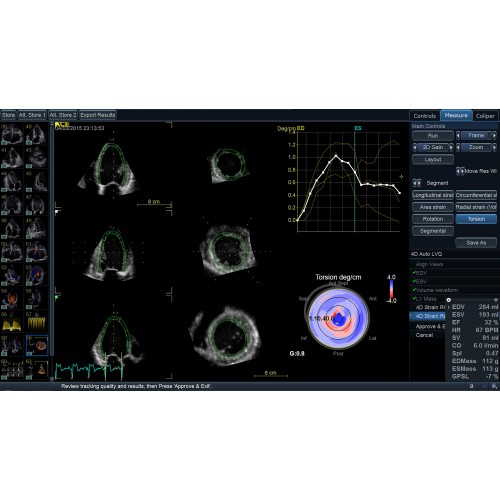 ViewPoint 6 и комплект EchoPAC Suite для кардиологических исследований